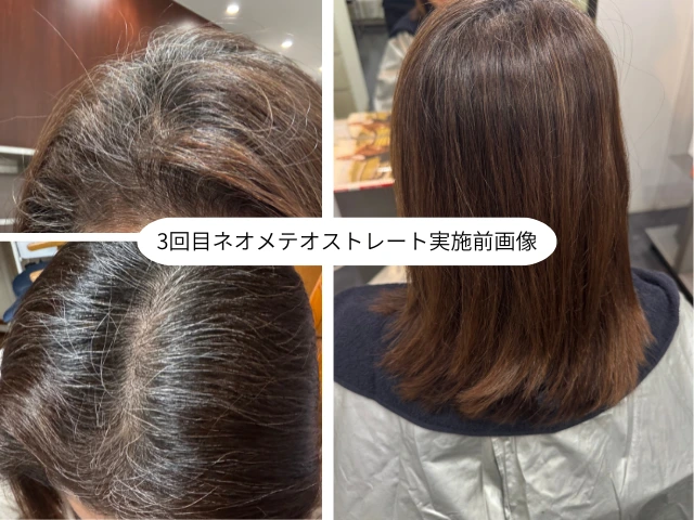 3回目ネオメテオストレート実施前画像