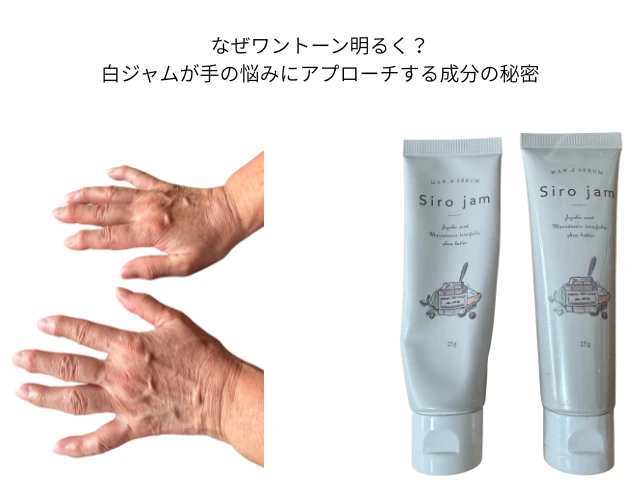 なぜワントーン明るく？ 白ジャムが手の悩みにアプローチする成分の秘密