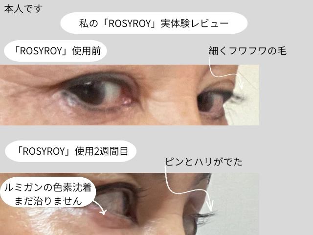 私の「ROSYROY」実体験レビュー