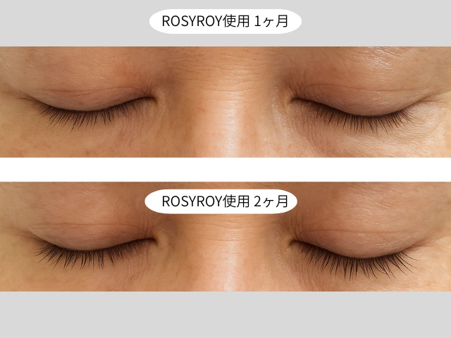 ROSYROY使用 1ヶ月ー2ヶ月