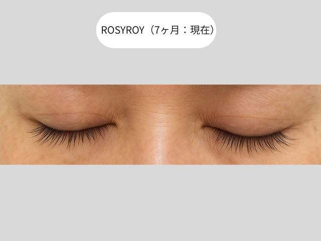 ROSYROY（7ヶ月：現在）