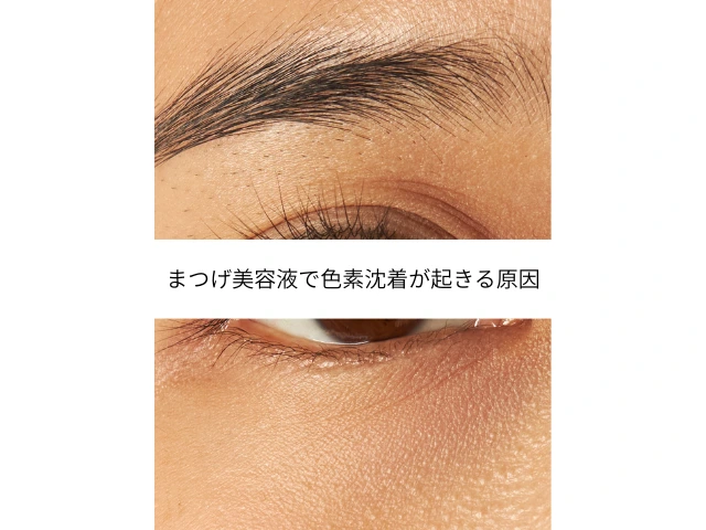 まつげ美容液で色素沈着が起きる原因
