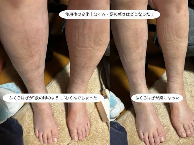 使用後の変化｜むくみ・足の軽さはどうなった？ 